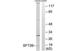 Image no. 1 for anti-Vesicle Transport Protein SFT2B (SFT2B) (AA 61-110) antibody (ABIN1535459)