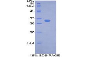 Image no. 1 for phosphoenolpyruvate Carboxykinase 1 (Soluble) (PCK1) (AA 311-558) protein (His tag) (ABIN1877500)