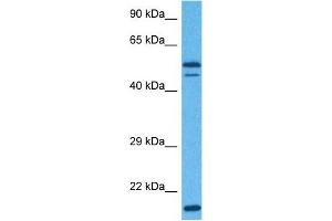 Image no. 2 for anti-Eukaryotic Translation Initiation Factor 3 Subunit E (EIF3E) (Middle Region) antibody (ABIN2783260)