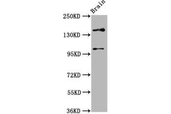 SOS1 Antikörper  (AA 1140-1281)
