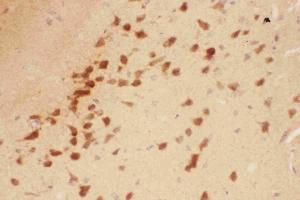 Image no. 4 for anti-Brain-Derived Neurotrophic Factor (BDNF) (AA 129-247) antibody (ABIN3043798)