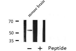Image no. 2 for anti-Aristaless Related Homeobox (ARX) (Internal Region) antibody (ABIN6257677)