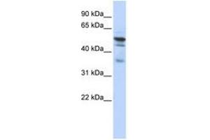 Image no. 1 for anti-N-Myristoyltransferase 1 (NMT1) (AA 108-157) antibody (ABIN6740963)