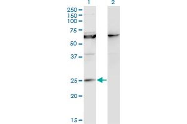 anti-Kv Channel Interacting Protein 1 (KCNIP1) (AA 1-216) antibody