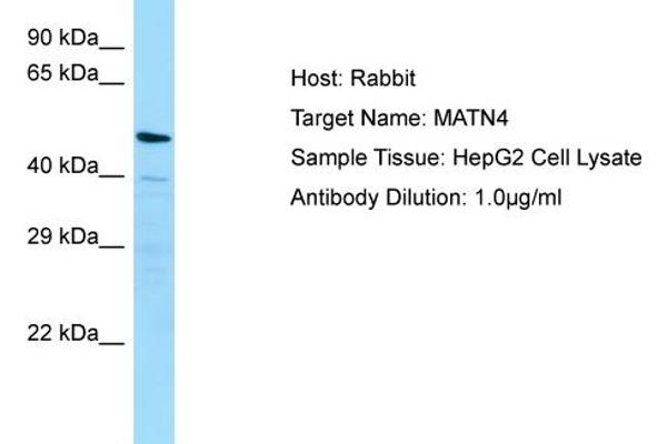 anti-Matrilin 4 (MATN4) (N-Term) antibody