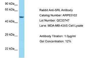 Image no. 1 for anti-Sarcalumenin (SRL) (C-Term) antibody (ABIN2789371)