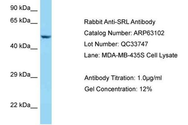 Sarcalumenin antibody  (C-Term)