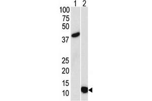 Image no. 1 for anti-Small Ubiquitin Related Modifier 3 (SUMO3) antibody (ABIN3029017)