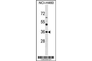 Image no. 1 for anti-N-Acetyltransferase 6 (GCN5-Related) (NAT6) (AA 150-179) antibody (ABIN1537881)
