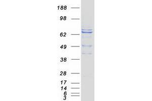 Image no. 1 for Rhophilin, rho GTPase Binding Protein 2 (RHPN2) protein (Myc-DYKDDDDK Tag) (ABIN2730879)