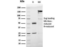 Image no. 1 for anti-Prohibitin (PHB) (AA 167-261) antibody (ABIN6940305)