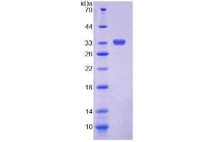 Image no. 1 for Chitotriosidase (CHIT1) (AA 193-466) protein (His tag) (ABIN6237591)