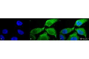 Image no. 2 for anti-Superoxide Dismutase 3, Extracellular (SOD3) (AA 227-236) antibody (APC) (ABIN2482053)