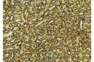 Image no. 1 for anti-Host Cell Factor C1 (VP16-Accessory Protein) (HCFC1) (N-Term) antibody (ABIN6262160)