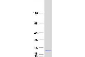 Image no. 1 for Mediator Complex Subunit 22 (MED22) (Transcript Variant C) protein (Myc-DYKDDDDK Tag) (ABIN2725740)