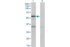 Image no. 2 for anti-serpin Peptidase Inhibitor, Clade A (Alpha-1 Antiproteinase, Antitrypsin), Member 10 (SERPINA10) (AA 22-444) antibody (ABIN565548)
