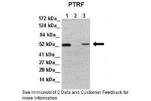 Image no. 5 for anti-Polymerase I and Transcript Release Factor (PTRF) (Middle Region) antibody (ABIN2779886)