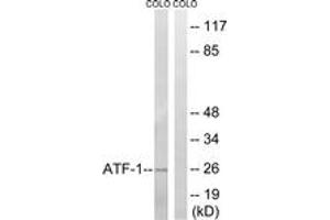 Image no. 1 for anti-Activating Transcription Factor 1 (AFT1) (AA 31-80) antibody (ABIN1532278)