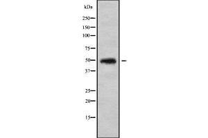 Image no. 1 for anti-Carbohydrate (N-Acetylglucosamine 6-O) Sulfotransferase 5 (CHST5) (Internal Region) antibody (ABIN6260833)