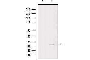 Image no. 3 for anti-Glycoprotein Ib (Platelet), beta Polypeptide (GP1BB) antibody (ABIN6262037)
