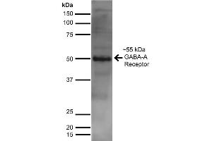 Image no. 1 for anti-gamma-aminobutyric Acid (GABA) A Receptor, alpha 1 (GABRA1) (AA 350-385) antibody (PE) (ABIN2485733)