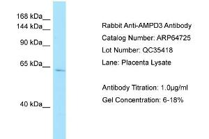 Western Blotting (WB) image for anti-Adenosine Monophosphate Deaminase 3 (AMPD3) (C-Term) antibody (ABIN2774406)