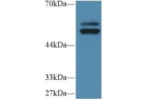 Image no. 1 for anti-Protein tyrosine Phosphatase, Non-Receptor Type 5 (Striatum-Enriched) (PTPN5) (AA 331-558) antibody (ABIN5014226)