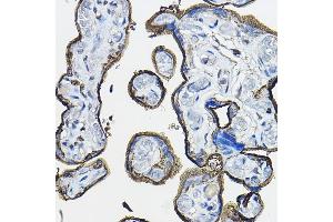 Immunohistochemistry of paraffin-embedded human placenta using CD46 Rabbit pAb (ABIN3022325, ABIN3022326, ABIN1512715, ABIN1513898 and ABIN6218741) at dilution of 1:100 (40x lens).