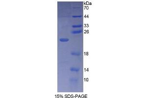 Image no. 1 for phospholipase C, beta 1 (phosphoinositide-Specific) (PLCB1) (AA 316-476) protein (His tag) (ABIN6238764)