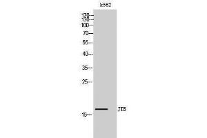 Image no. 1 for anti-Jumping Translocation Breakpoint (JTB) (N-Term) antibody (ABIN3180706)