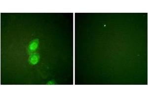 Immunofluorescence analysis of HuvEc cells, using Catenin-delta1 (Phospho-Tyr228) Antibody.