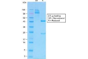 Image no. 1 for anti-Parathyroid Hormone (PTH) (AA 1-34) antibody (ABIN6940429)