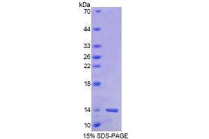 Image no. 1 for Barrier To Autointegration Factor 1 (BANF1) (AA 2-89) protein (His tag) (ABIN6238749)