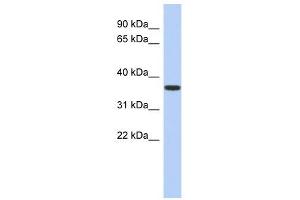 Image no. 1 for anti-Mevalonate Kinase (MVK) (N-Term) antibody (ABIN631917)