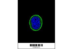 Image no. 3 for anti-Interleukin 10 Receptor, alpha (IL10RA) (AA 147-175) antibody (ABIN652714)