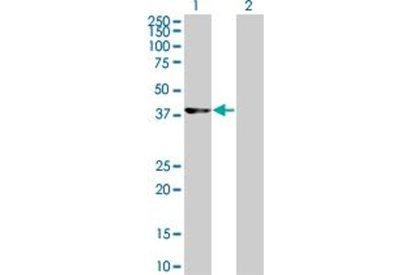 anti-Cyclin-Dependent Kinase 9 (CDK9) (AA 271-372) antibody