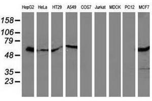 Image no. 4 for anti-Sequestosome 1 (SQSTM1) antibody (ABIN1499988)