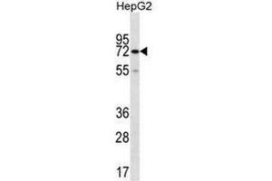 Image no. 2 for anti-CTP Synthase II (CTPS2) (AA 449-479), (C-Term) antibody (ABIN951729)