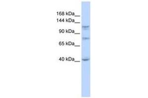 Image no. 1 for anti-DEAH (Asp-Glu-Ala-His) Box Polypeptide 30 (DHX30) (N-Term) antibody (ABIN6742683)