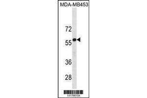 anti-UDP Glucuronosyltransferase 2 Family, Polypeptide B4 (UGT2B4) (AA 68-96), (N-Term) antibody