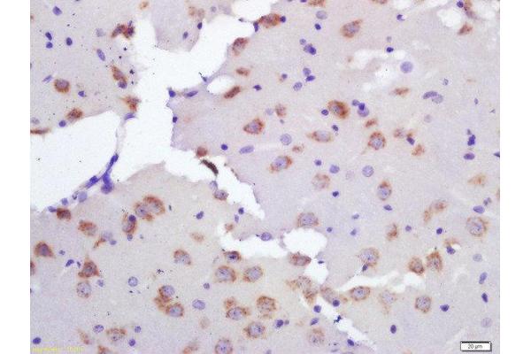 Ceramide Synthase 2 anticorps  (AA 201-300)