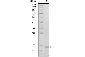 Image no. 2 for anti-EPH Receptor B6 (EPHB6) (AA 601-750) antibody (ABIN1724689)