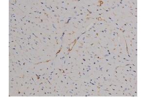 Image no. 1 for anti-Signal Transducer and Activator of Transcription 6, Interleukin-4 Induced (STAT6) (pTyr641) antibody (ABIN6256781)