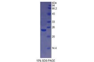 Image no. 1 for HLA Class II DR alpha (HLA-DRA) protein (ABIN3010605)