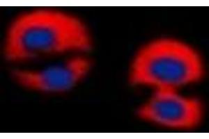 Image no. 1 for anti-erythrocyte Membrane Protein Band 4.9 (Dematin) (EPB49) (C-Term) antibody (ABIN2801198)