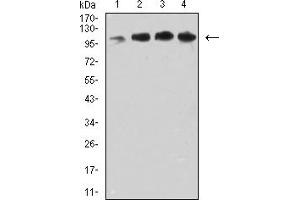 Image no. 3 for anti-Vascular Cell Adhesion Molecule 1 (VCAM1) (AA 25-183) antibody (ABIN5684098)