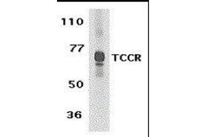 Image no. 1 for anti-Interleukin 27 Receptor, alpha (IL27RA) (C-Term) antibody (ABIN2474995)