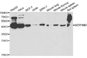 Image no. 1 for anti-serpin Peptidase Inhibitor, Clade B (Ovalbumin), Member 1 (SERPINB1) antibody (ABIN6570319)