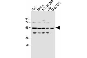 Image no. 4 for anti-6-phosphofructo-2-Kinase/fructose-2,6-Biphosphatase 4 (PFKFB4) (AA 266-296) antibody (ABIN392786)