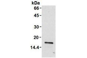 Image no. 1 for anti-Leukocyte Cell-Derived Chemotaxin 2 (LECT2) antibody (ABIN1108031)